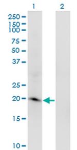 ARL2BP Antibody in Western Blot (WB)