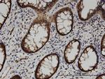 ACOT7 Antibody in Immunohistochemistry (Paraffin) (IHC (P))