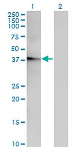 ACOT7 Antibody in Western Blot (WB)