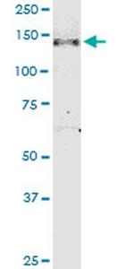 NPHP3 Antibody in Western Blot (WB)