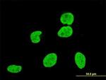 VPS8 Antibody in Immunocytochemistry (ICC/IF)