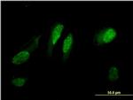 C13orf15 Antibody in Immunocytochemistry (ICC/IF)