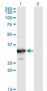 MYOZ2 Antibody in Western Blot (WB)