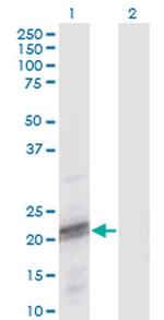 ODAM Antibody in Western Blot (WB)