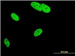 MED25 Antibody in Immunocytochemistry (ICC/IF)