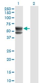 CHST12 Antibody in Western Blot (WB)