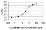 NOLA3 Antibody in ELISA (ELISA)