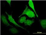 PUS1 Antibody in Immunocytochemistry (ICC/IF)