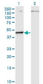 PUS1 Antibody in Western Blot (WB)