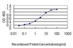 SLA2 Antibody in ELISA (ELISA)