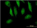 Myotrophin Antibody in Immunocytochemistry (ICC/IF)