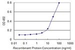 CENPV Antibody in ELISA (ELISA)