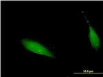 CENPV Antibody in Immunocytochemistry (ICC/IF)