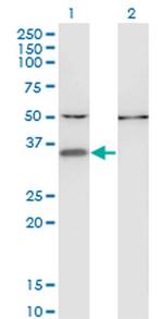 CENPV Antibody in Western Blot (WB)