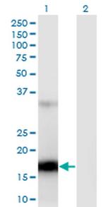 ZCCHC13 Antibody in Western Blot (WB)