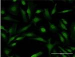 COMMD1 Antibody in Immunocytochemistry (ICC/IF)