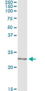 COMMD1 Antibody in Immunoprecipitation (IP)