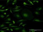 MTMR3 Antibody in Immunocytochemistry (ICC/IF)