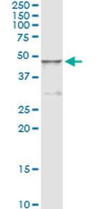 HGD Antibody in Immunoprecipitation (IP)