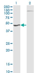 HGD Antibody in Western Blot (WB)