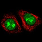 Adenosine Deaminase Antibody in Immunocytochemistry (ICC/IF)