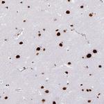 Adenosine Deaminase Antibody in Immunohistochemistry (Paraffin) (IHC (P))