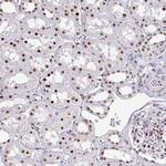 Adenosine Deaminase Antibody in Immunohistochemistry (Paraffin) (IHC (P))