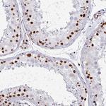 Adenosine Deaminase Antibody in Immunohistochemistry (Paraffin) (IHC (P))