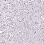 SIX1 Antibody in Immunohistochemistry (Paraffin) (IHC (P))