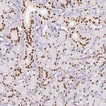 SIX1 Antibody in Immunohistochemistry (Paraffin) (IHC (P))