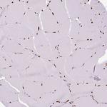 SIX1 Antibody in Immunohistochemistry (Paraffin) (IHC (P))