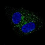 Fibulin 1 Antibody in Immunocytochemistry (ICC/IF)