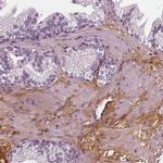 Fibulin 1 Antibody in Immunohistochemistry (IHC)