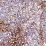 Fibulin 1 Antibody in Immunohistochemistry (IHC)