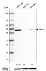 P4HA2 Antibody