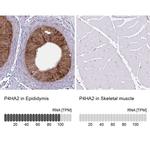 P4HA2 Antibody in Immunohistochemistry (IHC)