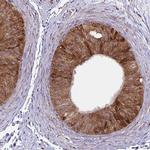 P4HA2 Antibody in Immunohistochemistry (IHC)