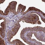 P4HA2 Antibody in Immunohistochemistry (IHC)