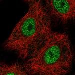 TCF2 Antibody in Immunocytochemistry (ICC/IF)