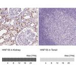 TCF2 Antibody in Immunohistochemistry (IHC)