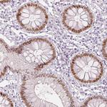 TCF2 Antibody in Immunohistochemistry (IHC)