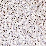 TCF2 Antibody in Immunohistochemistry (IHC)