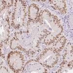 TCF2 Antibody in Immunohistochemistry (IHC)