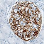 PLA2R1 Antibody in Immunohistochemistry (IHC)