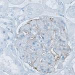 PLA2R1 Antibody in Immunohistochemistry (Paraffin) (IHC (P))