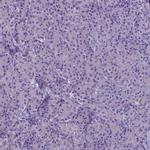 PLA2R1 Antibody in Immunohistochemistry (IHC)