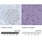 PLA2R1 Antibody