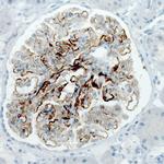 PLA2R1 Antibody in Immunohistochemistry (Paraffin) (IHC (P))