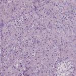 PLA2R1 Antibody in Immunohistochemistry (Paraffin) (IHC (P))