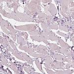 PLA2R1 Antibody in Immunohistochemistry (Paraffin) (IHC (P))